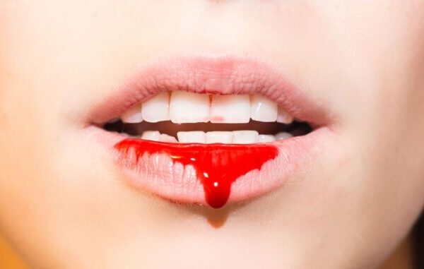 Vampire Elite